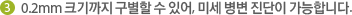 3 0.2mm 크기까지 구별할 수 있어, 미세 병변 진단이 가능합니다.