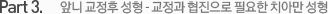 Part 3. 앞니 교정후 성형 - 교정과 협진으로 필요한 치아만 성형