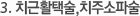 3. 치근활택술,치주소파술