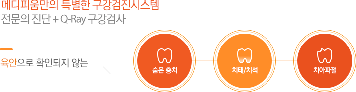 메디피움만의 특별한 구강검진시스템 전문의 진단 + Q-Ray 구강검사 육안으로 확인되지 않는 숨은 충치 치태/치석 치아파절