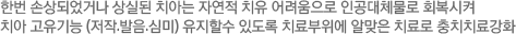 한번 손상되었거나 상실된 치아는 자연적 치유 어려움으로 인공대체물로 회복시켜 치아 고유기능 (저작.발음.심미) 유지할수 있도록 치료부위에 알맞은 치료로 충치치료강화